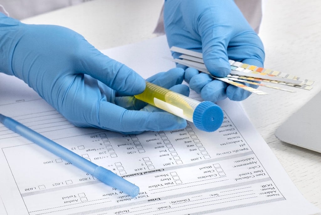 blood test dehradun