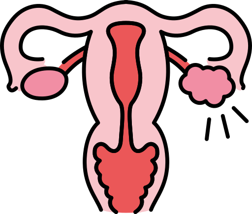 PCOS