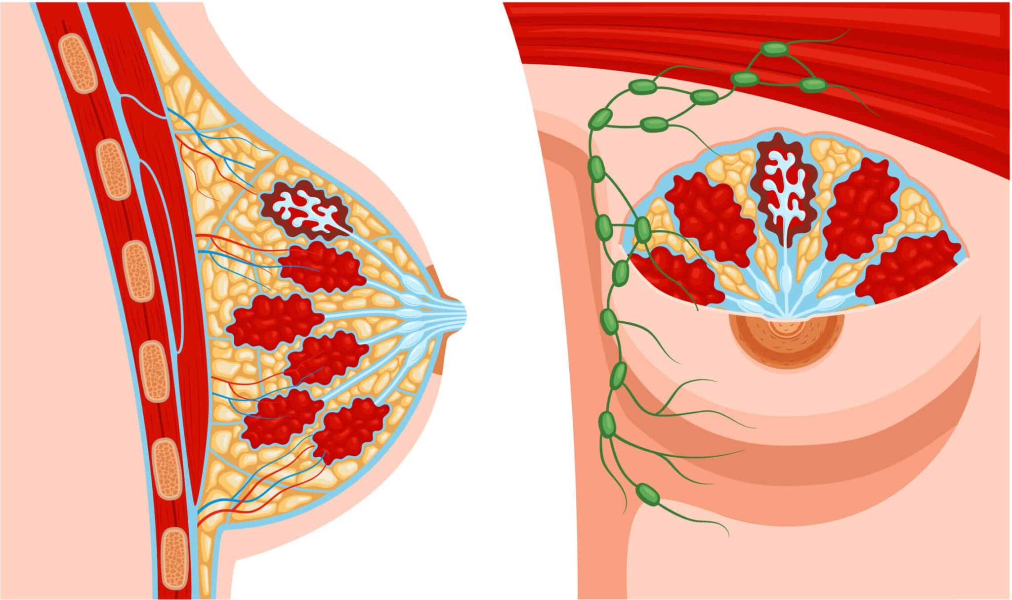 Common Medical Conditions Diagnosed Through Mammography