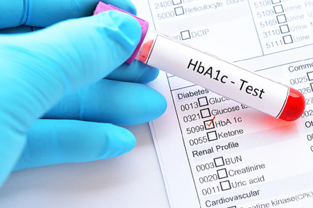 What is Normal HBA1C By Age and How to Control it
