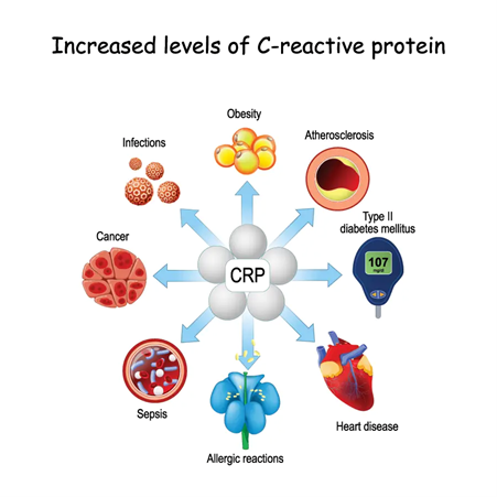 How to Reduce C-Reactive Protein in 2026: Treatment and Management