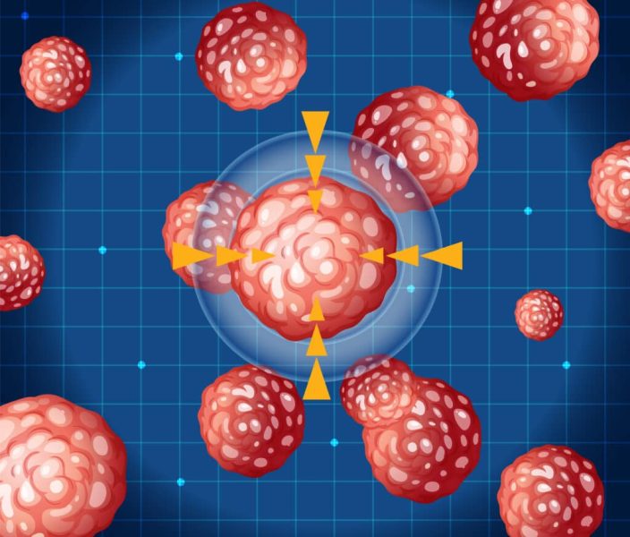 Vector illustration of cancer cells with a focus on one central cell, vibrant colors, and a grid background